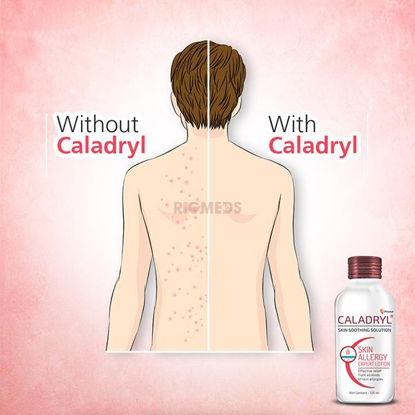 Caladryl Lotion (65ml)